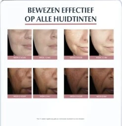 Eucerin Anti-Pigment Spotcorrector - Concealer - 5 Ml -Cosmeticawinkel 1157x1200