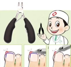 Professionele Nagelschaar Voor Ingegroeide Teennagels- Manicure - Pedicure - Voetverzorging 10 Professionele Nagelschaar Voor Ingegroeide Teennagels- Manicure - Pedicure - Voetverzorging -Cosmeticawinkel 1200x1140 8