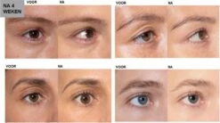 L'Oréal Paris Clinically Proven Wimperserum - 2 Ml 24 L'Oréal Paris Clinically Proven Wimperserum - 2 Ml -Cosmeticawinkel 1200x670 2