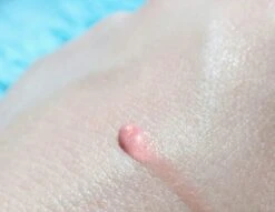 Biodermal Sun Lipbalm SPF25 - Tube 12 Ml - Natural Pink - Lippenbalsem 9 Biodermal Sun Lipbalm SPF25 - Tube 12 Ml - Natural Pink - Lippenbalsem -Cosmeticawinkel 1200x927 1